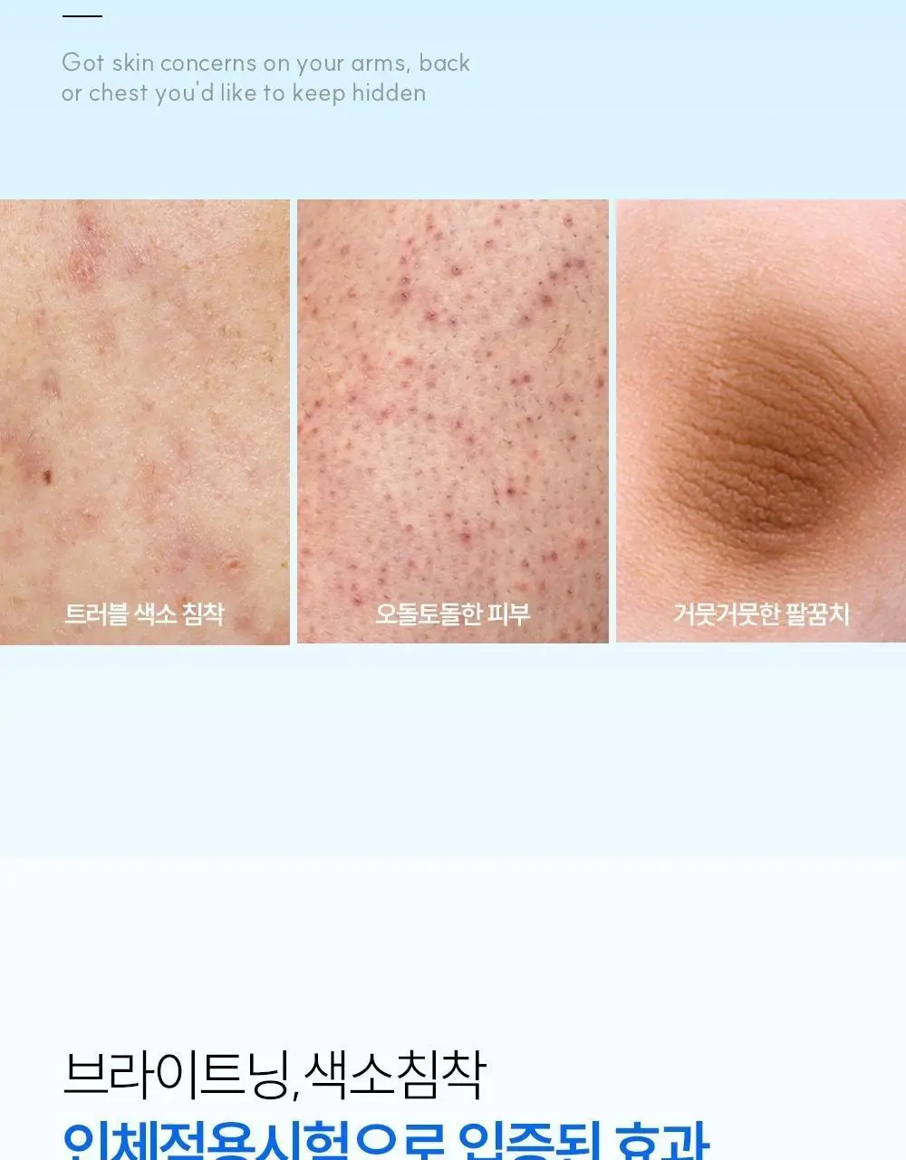 [트러블 흔적 7일개선] 오프온 수분진정 바디미스트(시카 흔적케어) 상세페이지 7